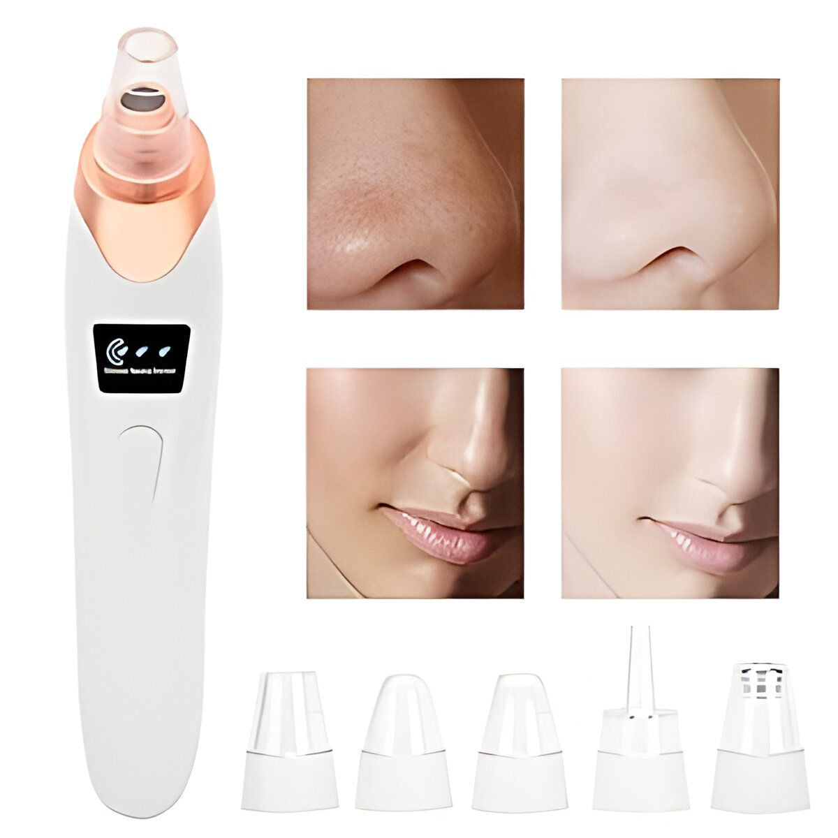 5 in 1 Electric Rechargeable Black Head Remover